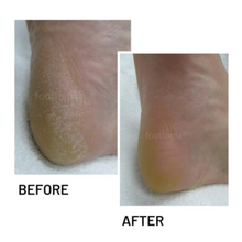 Load image into Gallery viewer, Footlogix Cracked Heel Formula #3+